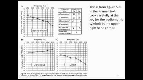 Lecture 2b Pure tone audiometry pt2 EQd