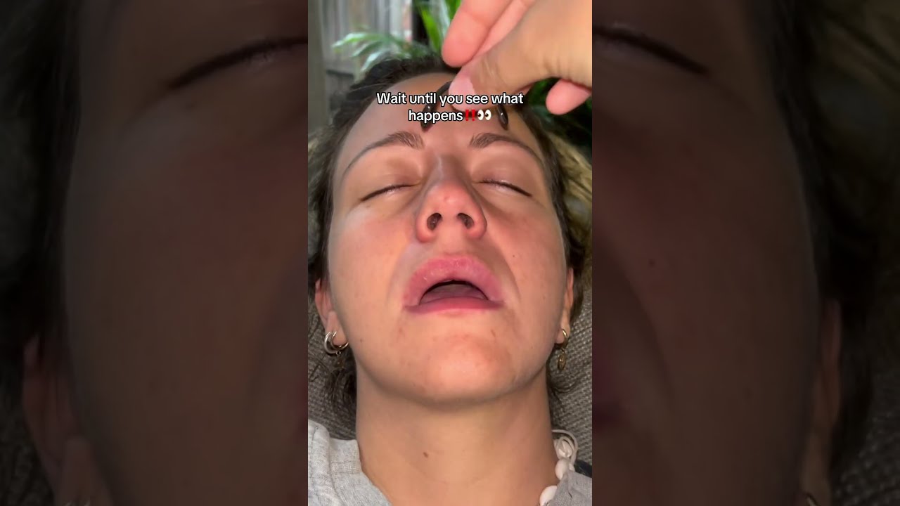 These Magnetic Nose Strip Helped Me To Stop Snoring Ans Sleep Better Breatheeasy