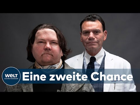 Video: Nur 72 Stunden: Der Chirurg Bewertete Die Chancen Von Priluchny, Das Alte Gesicht Zurückzugeben