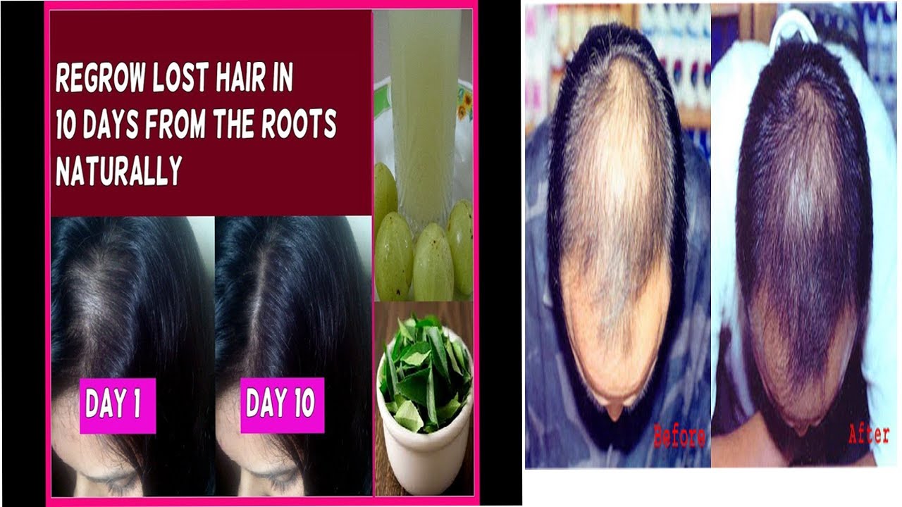 How To Promote Hair Growth Naturally How To Promote Hair Growth Naturally