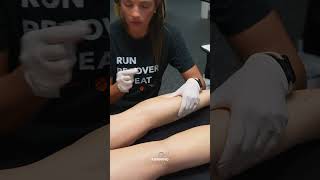 Dry Needling Tight Calves for Runners 👀