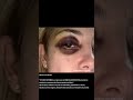 Alberto Fernández: el genocida golpeador de mujeres #shorts