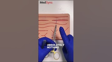 Leden: Bekijk de nieuwste video ALLEEN VOOR LEDEN over het oplossen van het ultieme gênante probl...