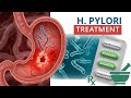 Helicobacter pylori: Current Approaches to Diagnosis and Treatment”
