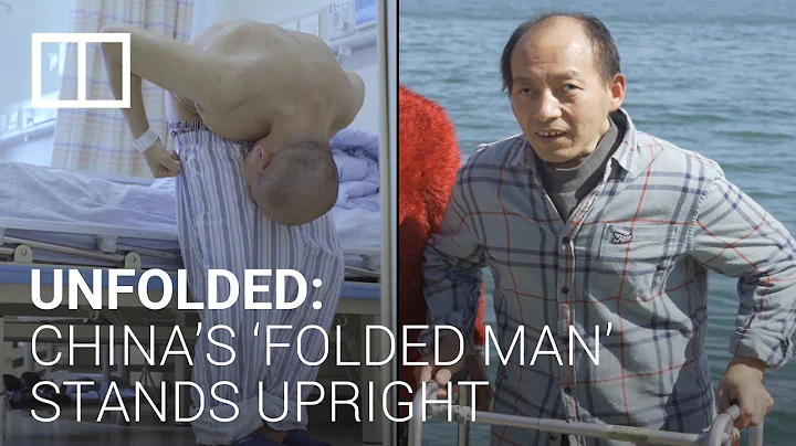 China’s ‘folded man’ finds happiness on road to recovery after complicated surgeries - DayDayNews