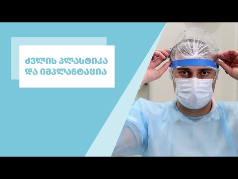 ძვლის პლასტიკა და იმპლანტაცია - ქირურგ-იმპლანტოლოგი ზურაბ ქურდიანი