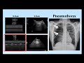 PoCUS in ICU - ICU Masterclass Course 2024