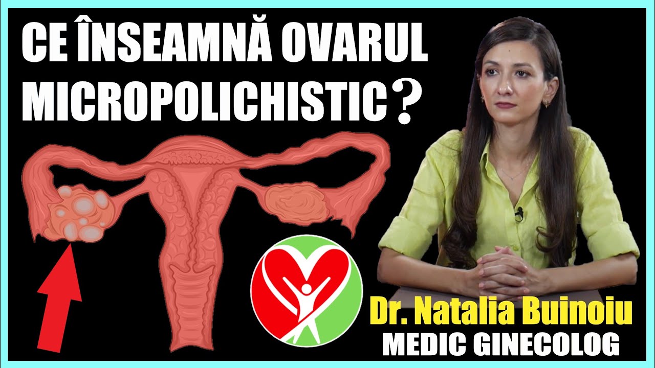 CE ÎNSEAMNĂ OVARUL MICROPOLICHISTIC? | Dr. Natalia Buinoiu - Medic Ginecolog