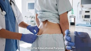 Intramuscular injection | nursing  | nursing skills | injection site.