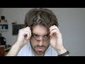 Has My Hair Started Thinning? | Men's Hair Loss