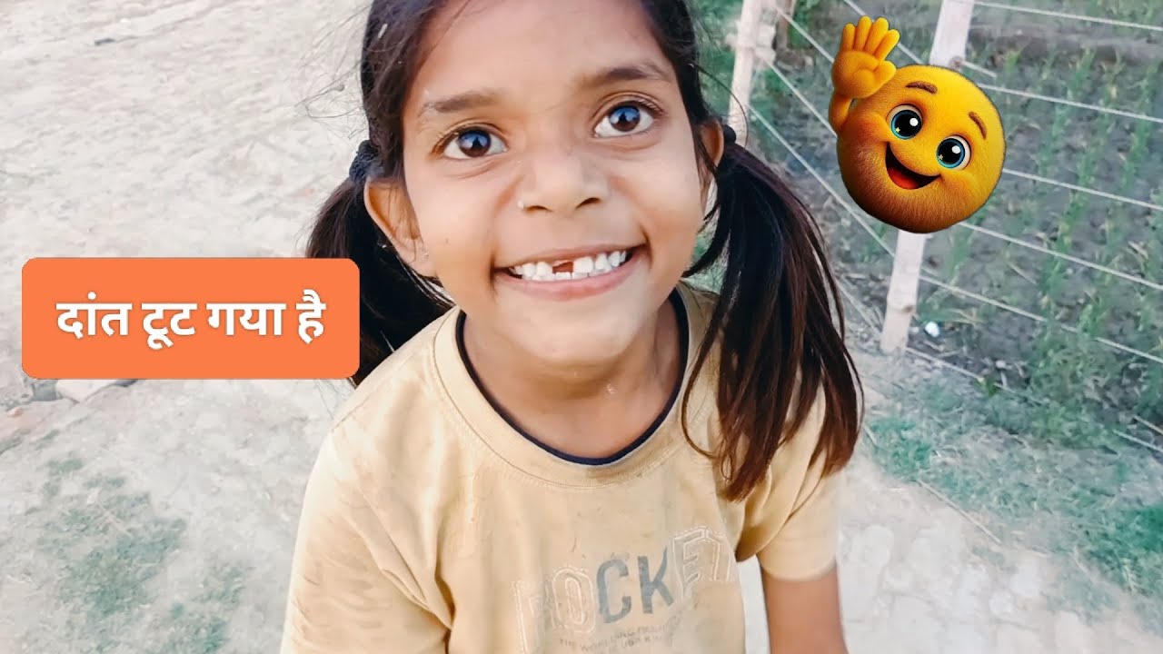 दांत टूट गया😭 फिर भी मस्ती😎