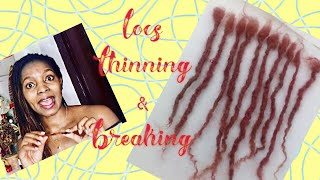 WHY YOUR LOCS ARE THINNING/BREAKING||HOW TO STOP LOCS FROM THINNING/BREAKING