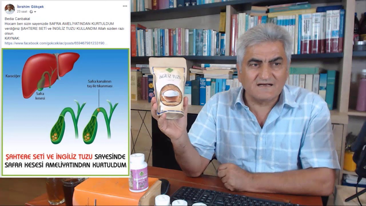 Safra Kesesi Taşı Nasıl Tedavi Edilir ? Safra Kesesinde Taş Olanlar Ne Safra Kesesi Taşı Nasıl Tedavi Edilir ? Safra Kesesinde Taş Olanlar Ne