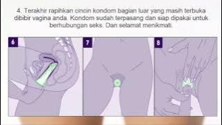 Cara memakai kondom wanita yang benar