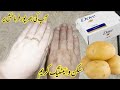 Skin Whitening Cream | Homemade Skin Whitening Remedie | Pahli bar istamal sa farak zahir