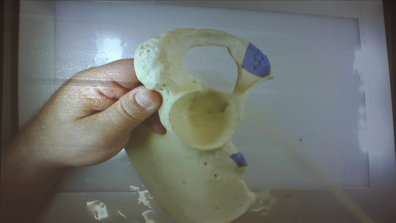 Coxal bone camera iphone 8 plus apk