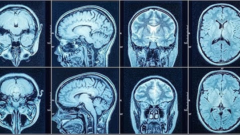 The Scientific Basis For Telepathy: It