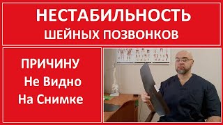 Нестабильность Шейного Отдела Позвоночника. Подробный Разбор Причины и Лечения.