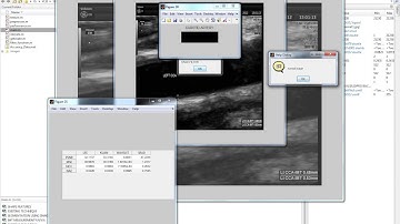 A Comparison of ultrasound Intima-media Thickness Measurements of the Left and Right Common Carotid