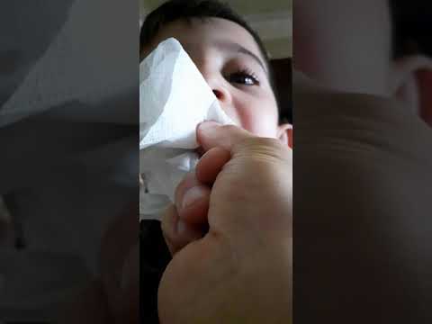 Video: Ինչպես երեխային ատամ հանել