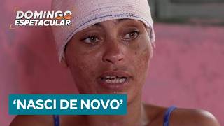 ‘Nasci de novo’, conta mulher dada como morta após atropelamento