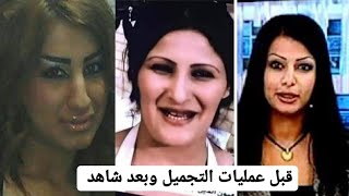 فنانات واعلاميات عراقيات قبل عمليات التجميل وبعد شاهد #محمد_الكظماوي