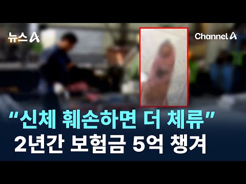 “신체 훼손하면 더 체류”…2년간 보험금 5억 챙겨 / 채널A / 뉴스A