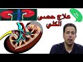 حقيقة حصى الكلي وطرق الوقاية والعلاج مع الدكتور محمد احليمي||Mohammed Ahlimi