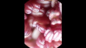 Почки Красного Тополя Под Микроскопом short #shorts