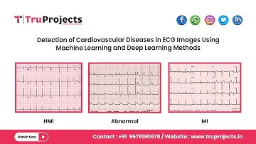 Detection of Cardiovascular Diseases in ECG Images Using Machine Learning and Deep Learning Methods