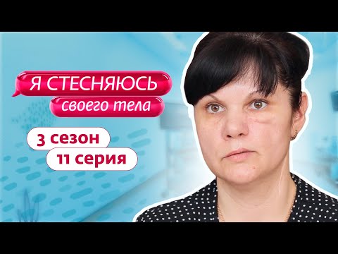 Я СТЕСНЯЮСЬ СВОЕГО ТЕЛА. РОССИЯ - СЕЗОН 3 ВЫПУСК 11