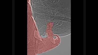 Tsetse Flies Mating Behavior X-Ray Glossina Pallidipes Corregido