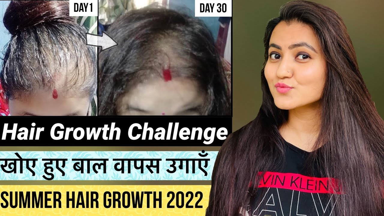 30 Days SUMMER HAIR GROWTH CHALLENGE : REGROW LOST HAIR, GET DOUBLE DENSITY  & THICK HAIR in 30 Days - YouTube