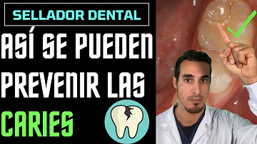 ¿Cómo evitar el avance de la caries?