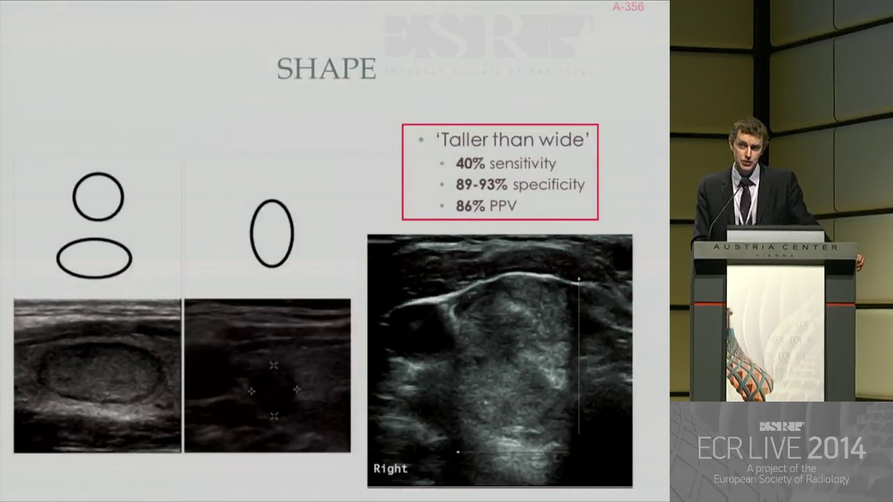 H&N SF 12   Imaging of thyroid nodules 3