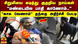 சிறுமியை கடித்து குதறிய நாய்கள் 