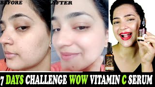 7 Days Challenge || WOW Vitamin C Serum with Hyaluronic Acid.... Does It Really Work#HonestReview