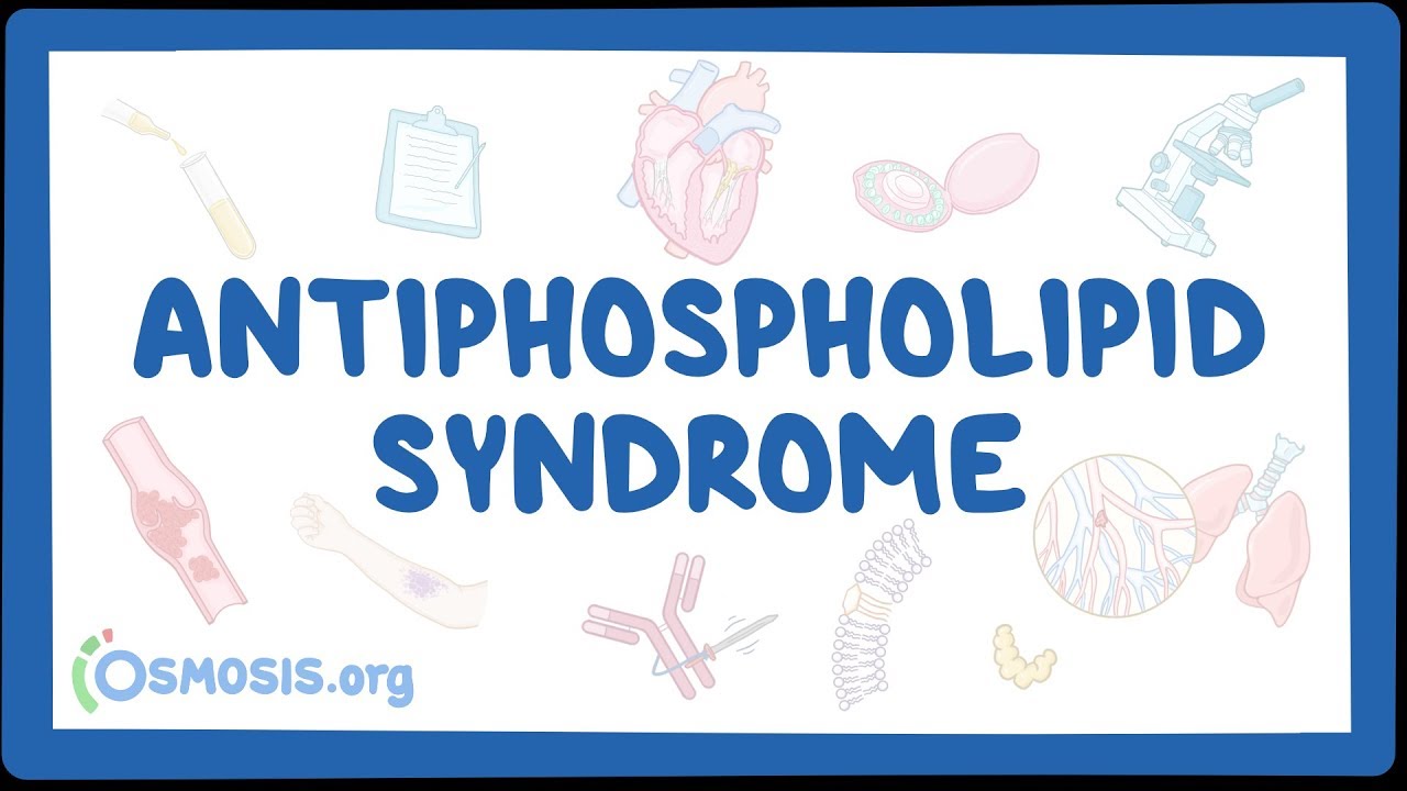 Antiphospholipid syndrome - causes, symptoms, diagnosis, treatment, pathology