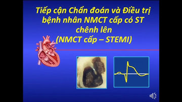 Nhồi máu cơ tim cấp ST chênh lên (STEMI) - Hội chứng vành cấp [Tim mạch 2525]