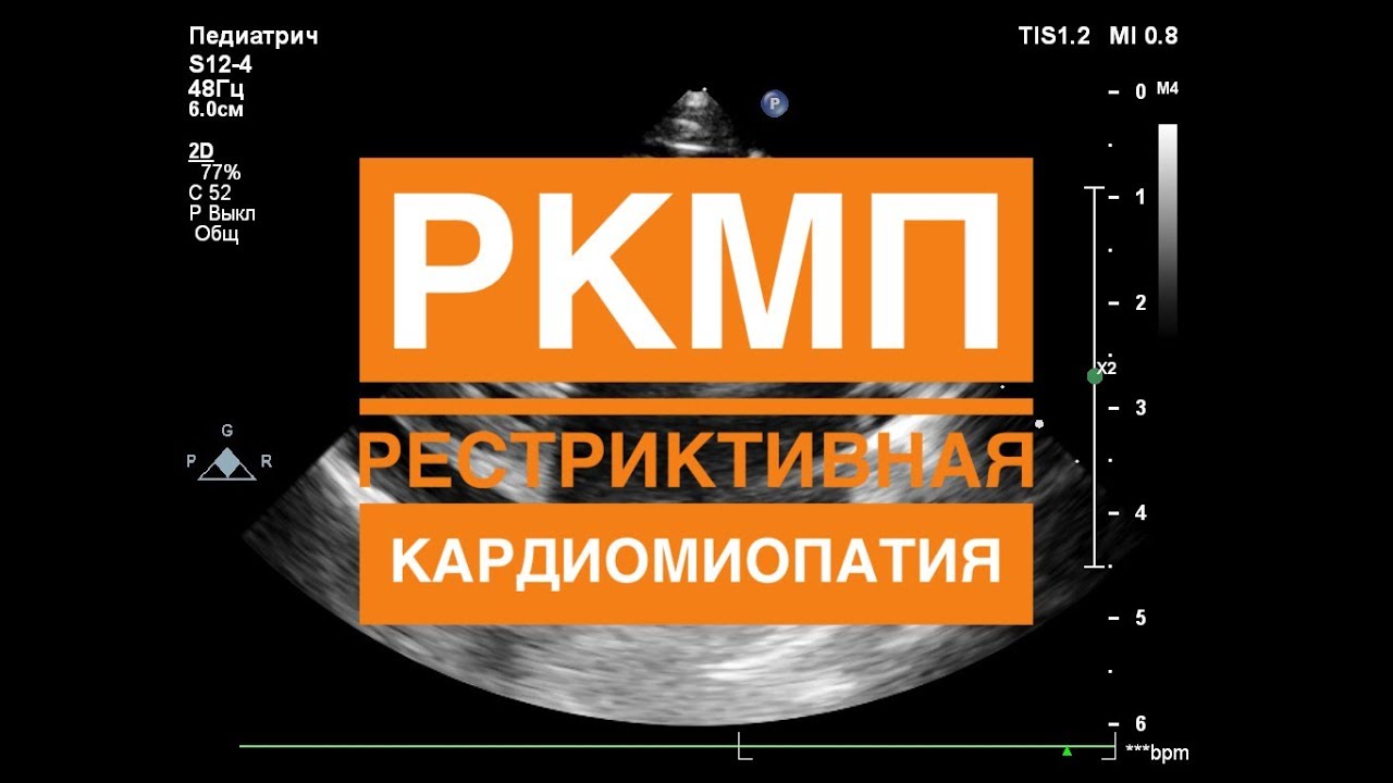 preview_player