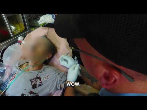 Narcan OD Reversal - Heroin and Opioid Crisis in the US - WRAL Documentary Bonus Content