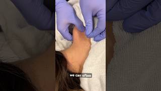 Dry needling is used to treat muscle pain, release muscle tension, and improve overall function.