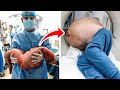 Shocked Doctors Remove 30 Pounds Of Poop Built Up For 22 Years