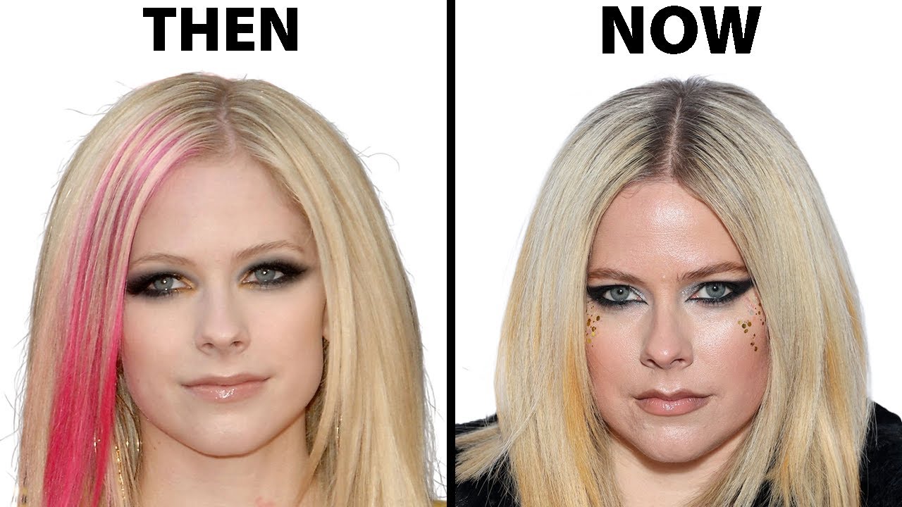 Avril Lavigne Plastic Surgery: Analysis of Cosmetic Procedures Over the Years