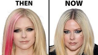 Did Avril Lavigne Have Plastic Surgery? | Plastic Surgery Analysis