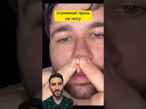 гигантский прыщ на носу