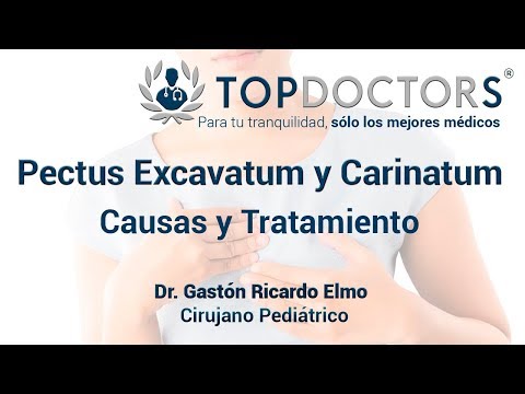 Pectus excavatum y Pectus carinatum: Causas y tratamiento