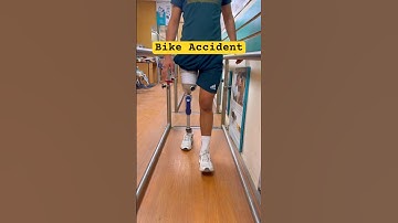 🫵Above Knee Prosthetic Leg | Ottobock 3R80 Price | Ossur Proflex XC | #ossur #3r80 #artificiallimb