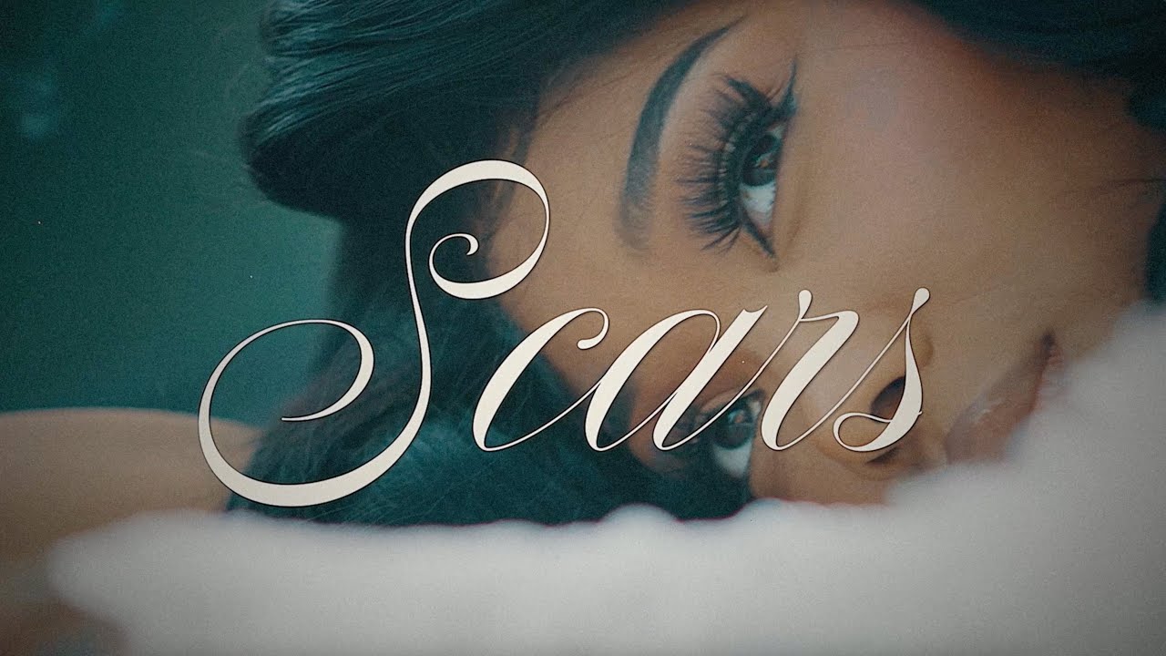 Scars