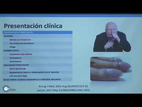 Vídeo: Fibrosis Pulmonar Idiopática Y Cáncer: ¿realmente Se Parecen?